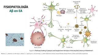 Biomarcadores en Enfermedad de Alzheimer [upl. by Ailaht976]