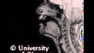 MRI voiced dental fricative [upl. by Sadnak]