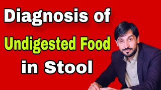 Undigested Food in Stool Causes amp Diagnosis  MLT Hub with kamran [upl. by Aydan]