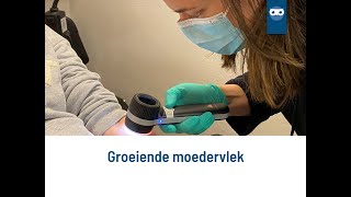 groeiende moedervlek [upl. by Stoffel775]