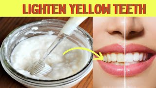 How to whiten your teeth at home in 1 day with baking soda [upl. by Adnov326]