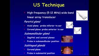 Ultrasound of the Salivary Glands [upl. by Samala]