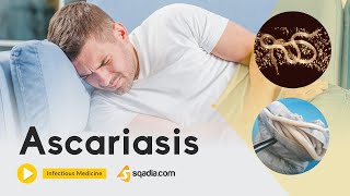 Ascariasis  Infectious Medicine Video  Medical Online Education  VLearning™ [upl. by Thurlow]