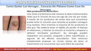 COMO ELIMINAR VERRUGAS  SIN VERRUGAS NI LUNARES [upl. by Watanabe]