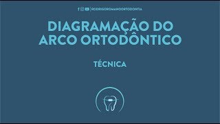 Diagramação dos Arcos Ortodônticos  Técnica [upl. by Giffer]