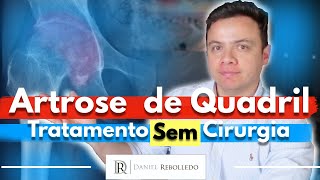 Artrose no Quadril 9 Dicas de Tratamento Sem Cirurgia [upl. by Ai310]