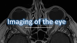 Imaging of the eye [upl. by Editha512]