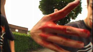 Skateboarding accidents falls crashes bails and pain Compilation [upl. by Atneuqal]