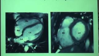 Cardiac MR imaging [upl. by Eissej]