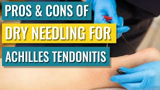 Dry Needling For Achilles Tendinopathy  Tendonitis — Does It Help [upl. by Fawcette]