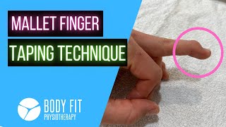 Mallet Finger I Taping Technique [upl. by Rehpotisrhc]