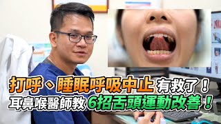 打呼、睡眠呼吸中止有救了！耳鼻喉醫師教6招舌頭運動改善！｜VS MEDIAｘ陳亮宇耳鼻喉科診所 [upl. by Siuqram]