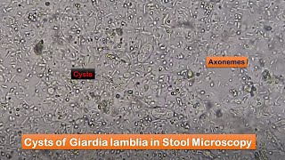 Stool Faeces Saline Wet Mount Preparation and Microscopy showing Giardia at various magnifications [upl. by Blanding]