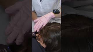 ASMR Nape amp SCALP Check Up  Analysis Real Person asmr shorts short [upl. by Binnings]