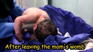 Cutest newborn baby moment after normal delivery with vernix on skin viralbaby [upl. by Ahsita]