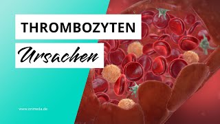 Thrombozyten zu hoch Mögliche Ursachen [upl. by Salohci]