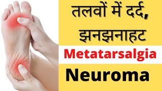 पैरों के तलवों में तेज दर्द और झनझनाहट  metatarsalgia  Interdigital Neuroma  By DrDushyant MS [upl. by Medardas]