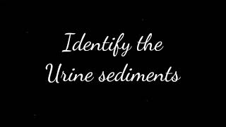 MEDTECH REVIEWUrine sediments flashcard [upl. by Eanel]