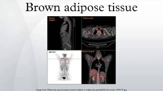 Brown adipose tissue [upl. by Annael]