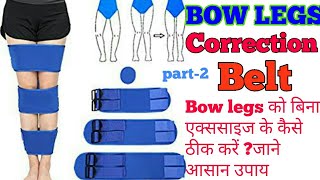 Bow legs correction Belt  bow legs को बिना एक्सरसाइज के कैसे ठीक करे जाने आसान उपाय। part 2 [upl. by Fromma]