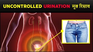 Urinary Bladder Incontinence Causes Symptoms amp Treatment  Hindi [upl. by Venetis176]