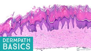 Basic Dermpath Cases  Explained by a Dermatopathologist [upl. by Nylacaj]