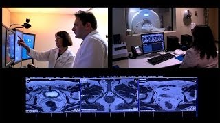 MRI for diagnosis and treatment of prostate cancer [upl. by Kurtis717]