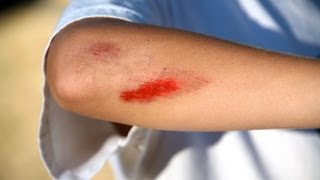 How to Treat Cuts amp Scrapes  First Aid Training [upl. by Nissa]