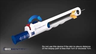 BioSentry™ tract sealant system [upl. by Mirth]