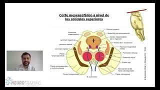 TALLO CEREBRAL ANATOMIA [upl. by Linell3]