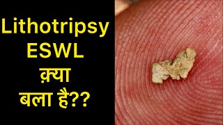 Lithotripsy Treatment for Kidney Stones in Hindi  Lithotripsy Side effects  ESWL Treatment [upl. by Gnel]