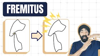 Fremitus and Occlusal Overload  Dental Occlusion Geekiness  PDP160 [upl. by Anthia221]