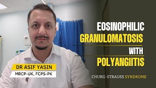 Eosinophilic Granulomatosis with Polyangiitis  ChurgStrauss Syndrome mbbs NRE plab fmge [upl. by Frederich]