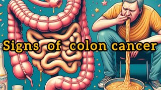 10 SIGNS OF COLON CANCER [upl. by Portland811]