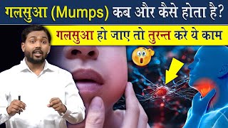 गलसुआ Mumps क्यों हो जाता है  गलसुआ हो जाते तो तुरंत करें ये काम ViralKhanSir [upl. by Akilegna30]