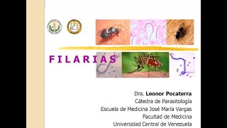 Filariasis linfática Wuchereria bancrofti  Mansonelosis [upl. by Patricio]