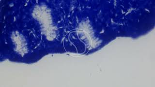 Helicobacter pylori Toluidine Blue Staining [upl. by Vtarj222]