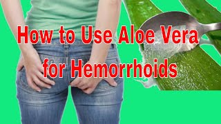 How to Use Aloe Vera for Hemorrhoids [upl. by Suoicerp]