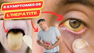 5 symptômes de lhépatite  hépatite virale c  hépatite virale b  hepatite a  hépatite [upl. by Varrian]