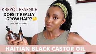 DOES IT GROW HAIR  Kreyol Essence Haitian Black Castor [upl. by Hillman220]