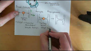 Angiogenesis and Angiotherapy Part 1 [upl. by Elora]