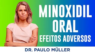 MINOXIDIL  EFEITOS COLATERAIS I O QUE SABER ANTES DE USAR I SAIBA QUAIS SÃO OS EFEITOS COLATERAIS [upl. by Nived]