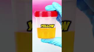 What colour is your Pee⚠️🚨urine health kidneydisease disease wellnessknowledge facts [upl. by Dlaner]