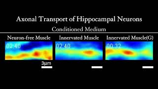 Axonal Transport of Hippocampal Neurons [upl. by Witte]