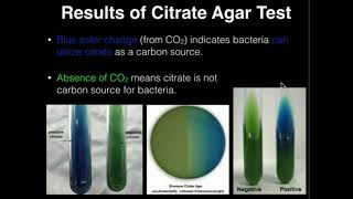 Microbiology Citrate Agar [upl. by Itsa]