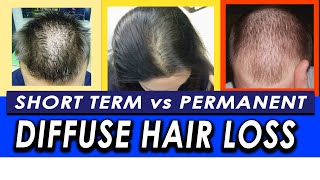 Permanent vs Temporary Diffuse Hair Loss and Telogen Effluvium How to differentiate [upl. by Dunc]