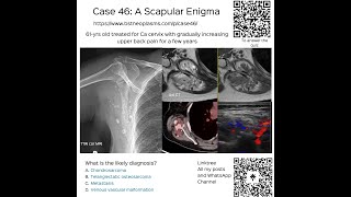 Case 46 A Scapular Enigma [upl. by Lomasi]