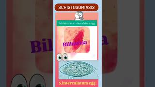 Schistosoma intercalatum egg BilharziaSchistosomiasis👍Parasitology👍🔬✅ [upl. by Erhart]