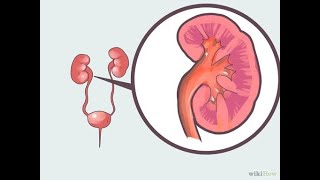 SINDROME NEFRITICO MEDICINA INTERNA [upl. by Publia873]