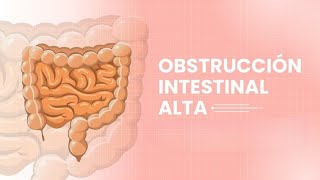 Estas son las causas de la obstrucción intestinal y de esta forma la podés curar [upl. by Assital]